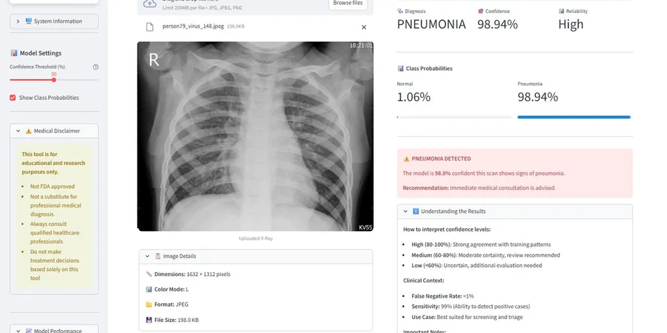 Detección de Neumonía en Rayos X (CheX-DS)